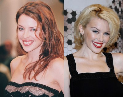пластические операции звезд: Кайли Миноуг (Kylie Minogue)